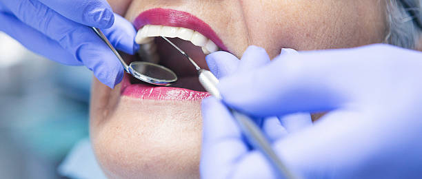 Best Emergency Tooth Extraction in Eustis, FL